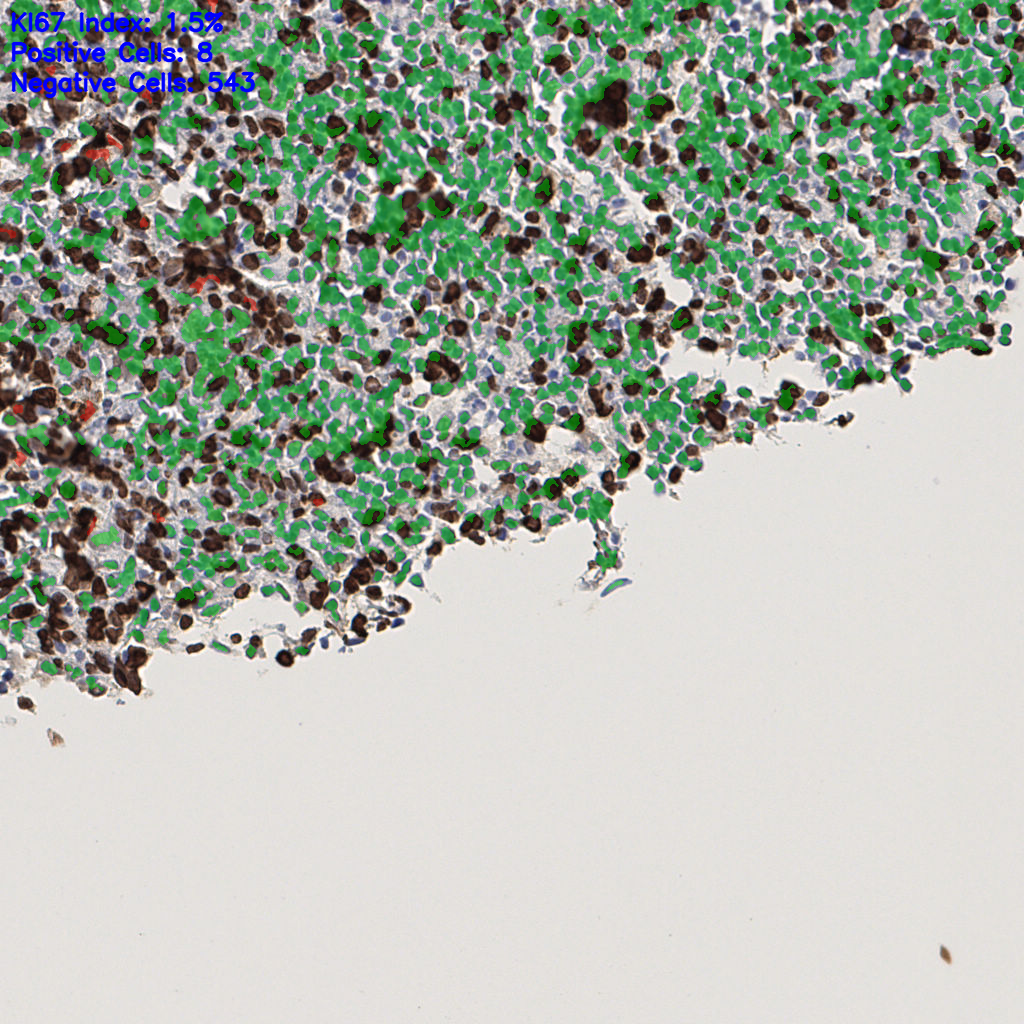 slice_49_5_x43904_y4480.png