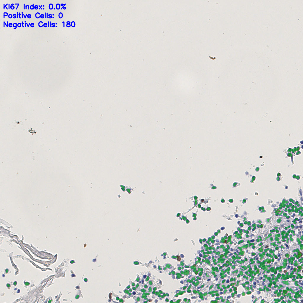 slice_4_10_x3584_y8960.png