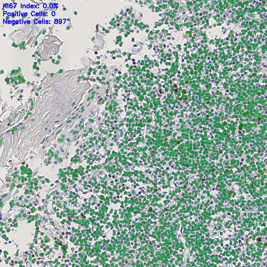 slice_4_11_x3584_y9856.png