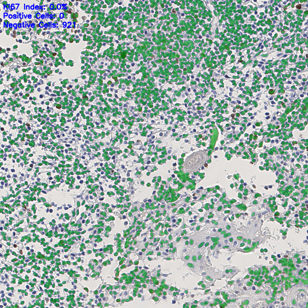 slice_4_12_x3584_y10752.png