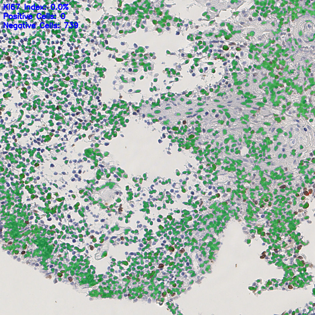 slice_4_13_x3584_y11648.png