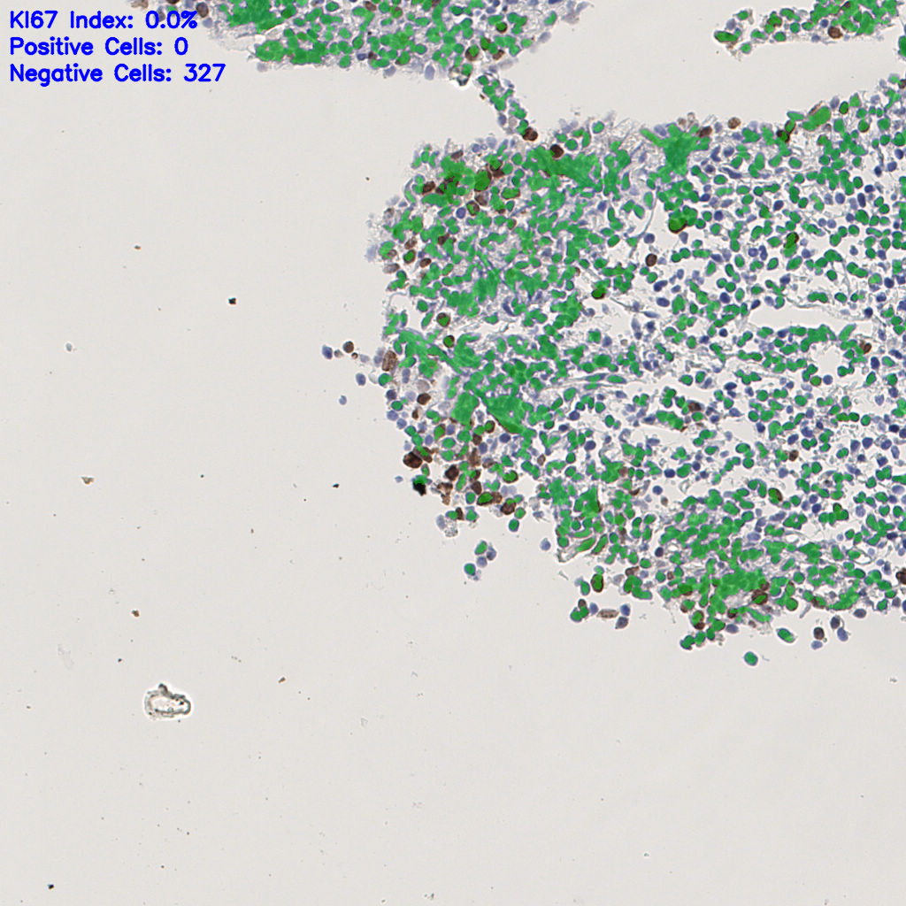 slice_4_14_x3584_y12544.png