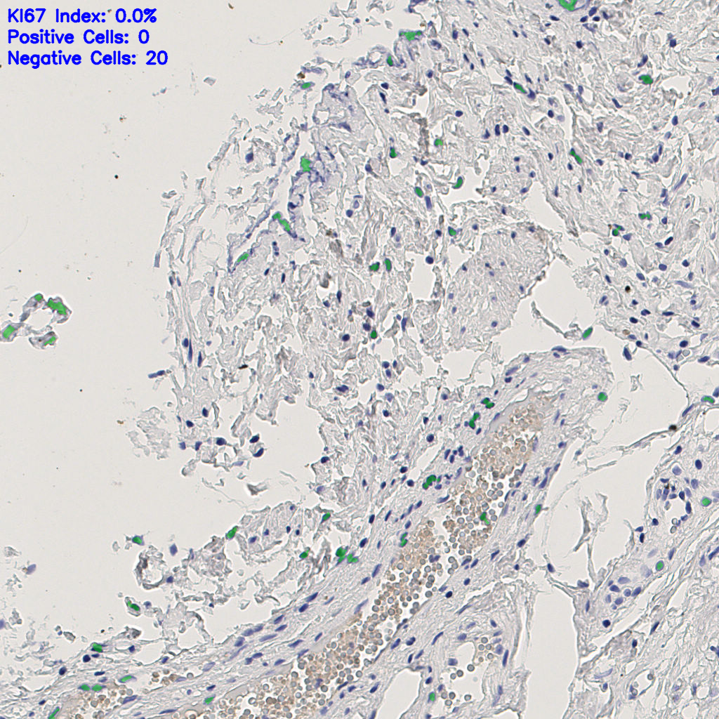 slice_4_20_x3584_y17920.png