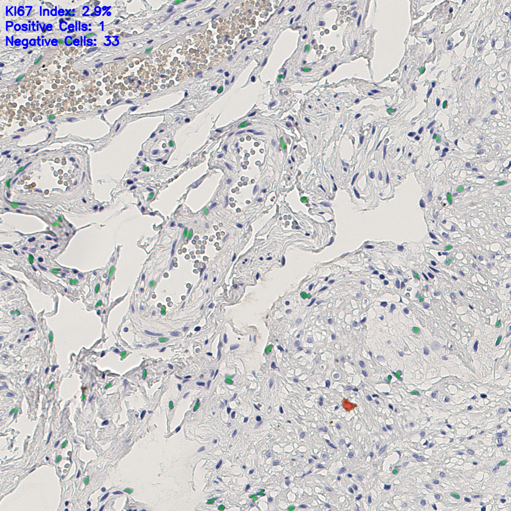 slice_4_21_x3584_y18816.png