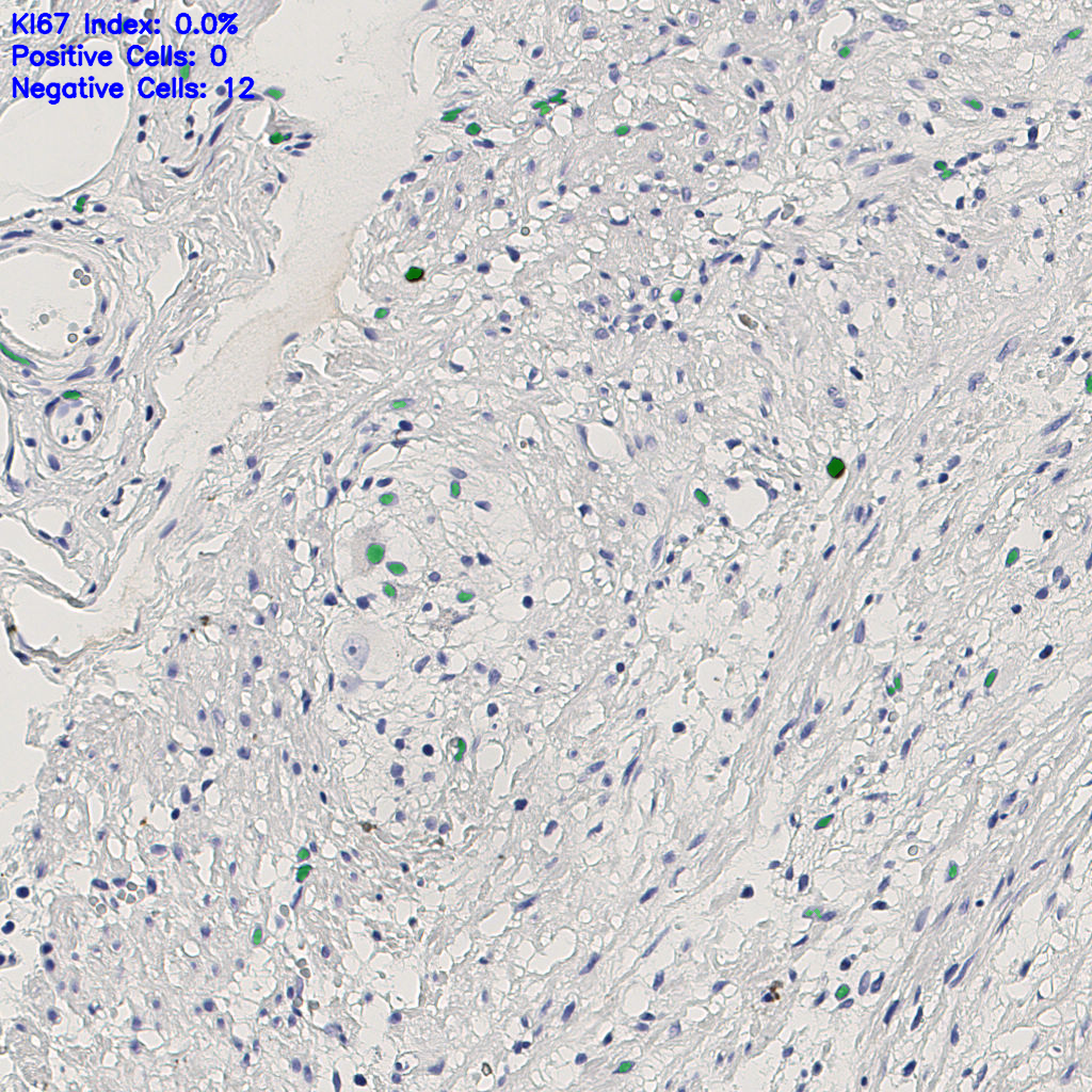 slice_4_22_x3584_y19712.png