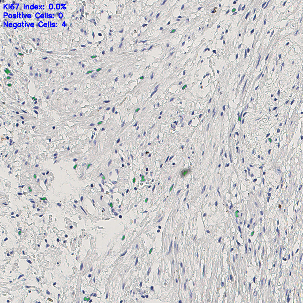 slice_4_23_x3584_y20608.png