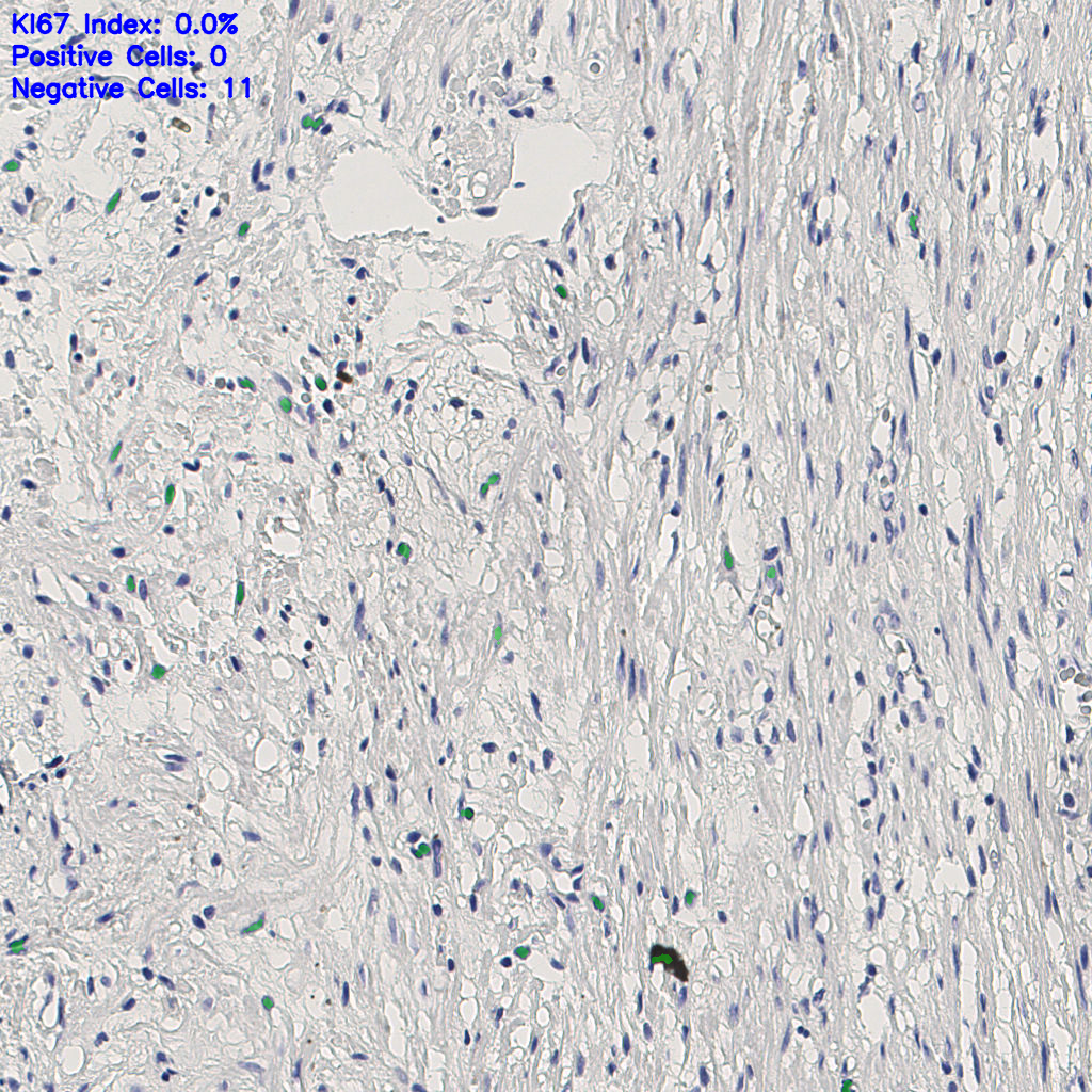 slice_4_24_x3584_y21504.png