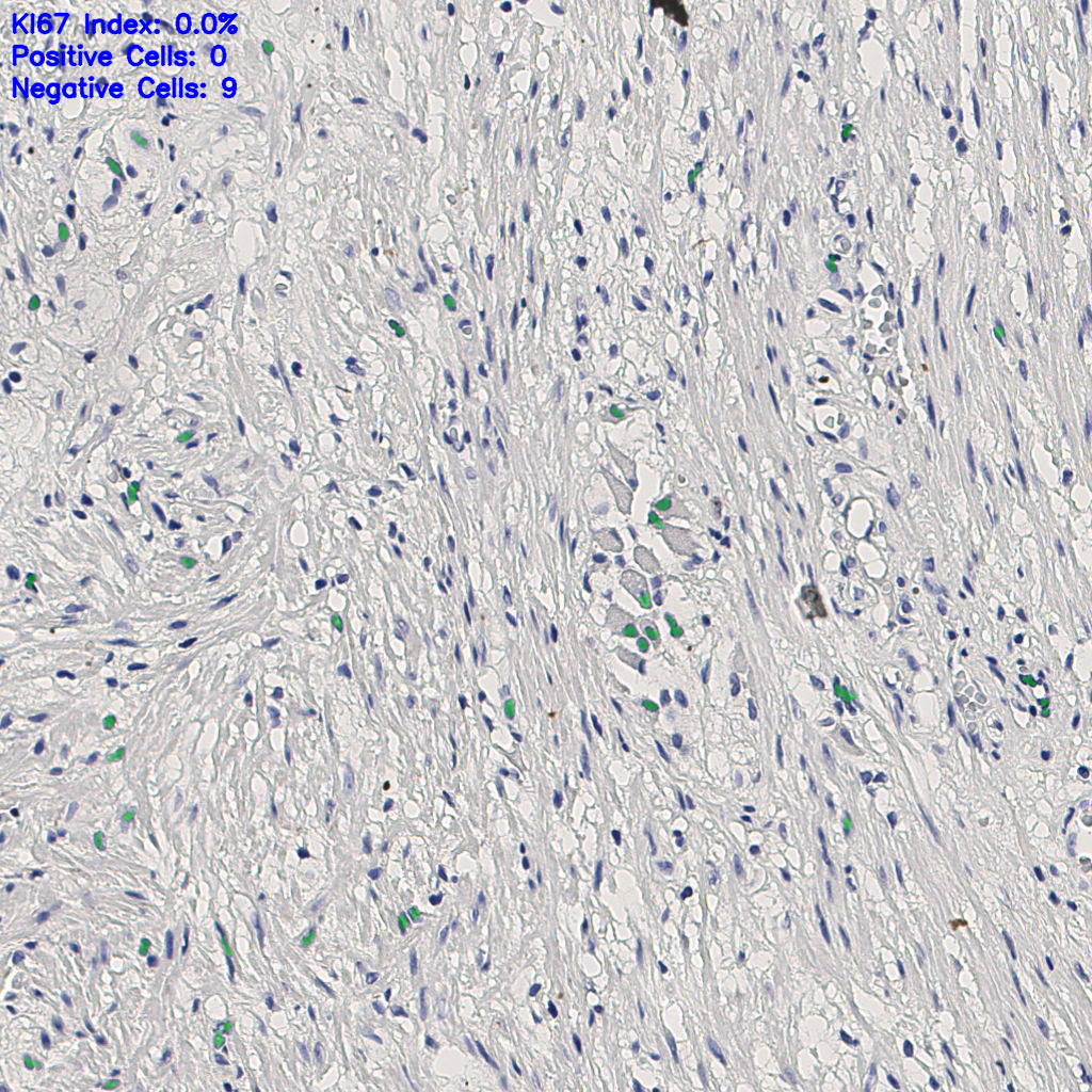 slice_4_25_x3584_y22400.png