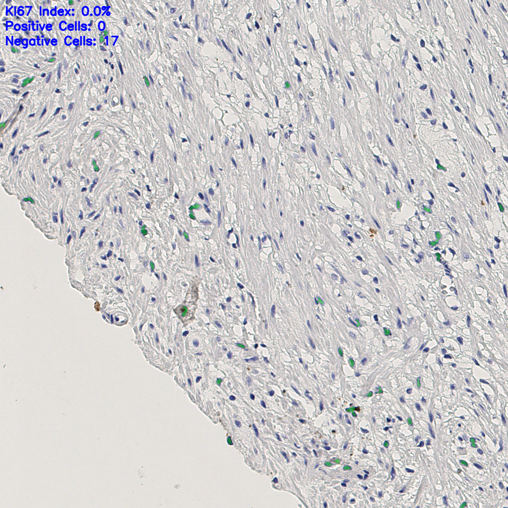 slice_4_26_x3584_y23296.png