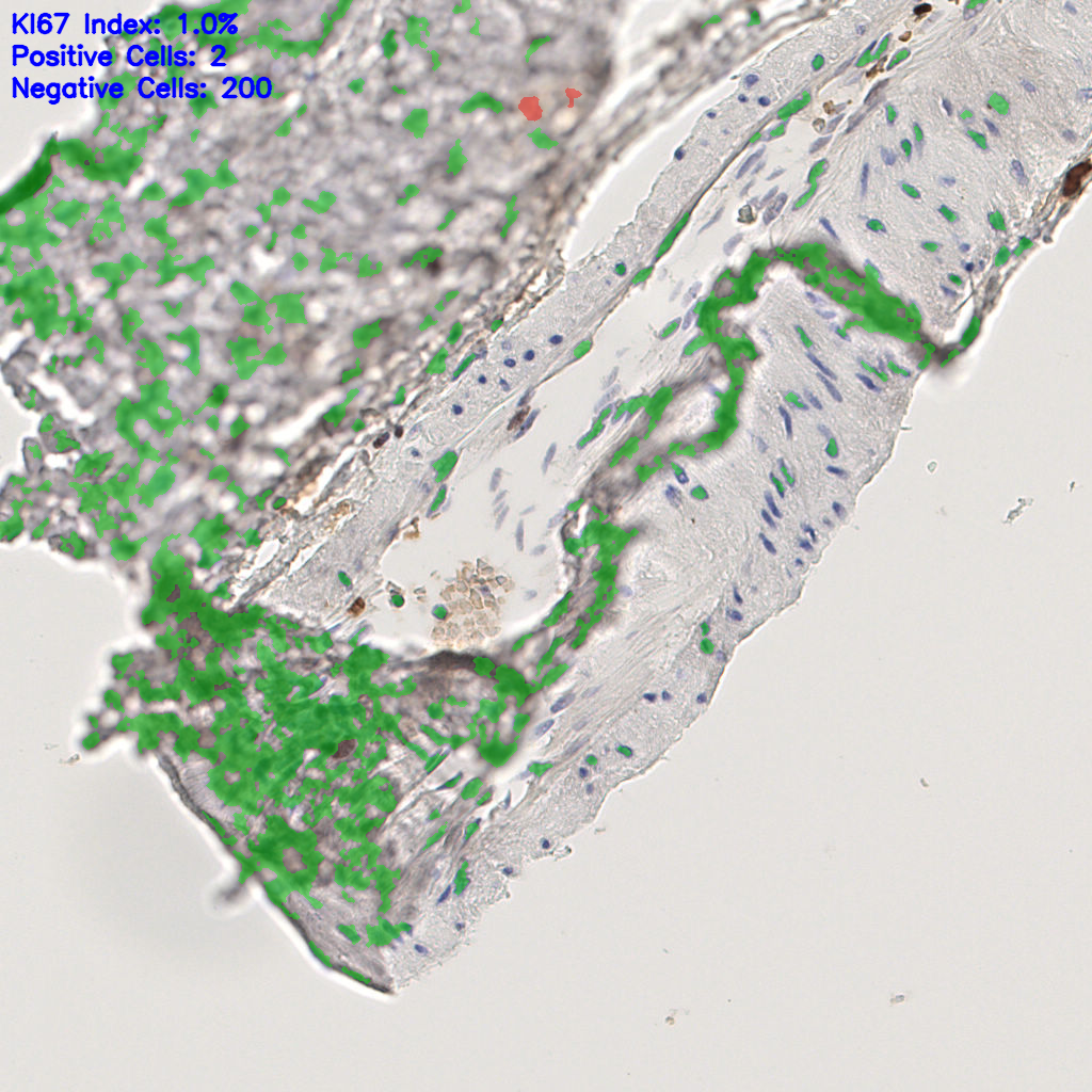 slice_50_10_x44800_y8960.png