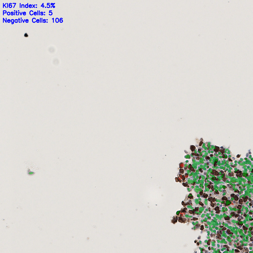 slice_50_18_x44800_y16128.png