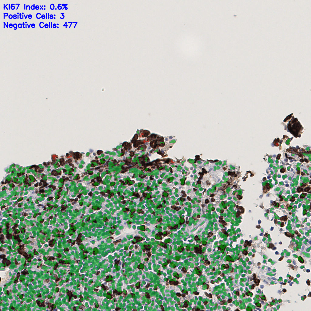 slice_50_3_x44800_y2688.png
