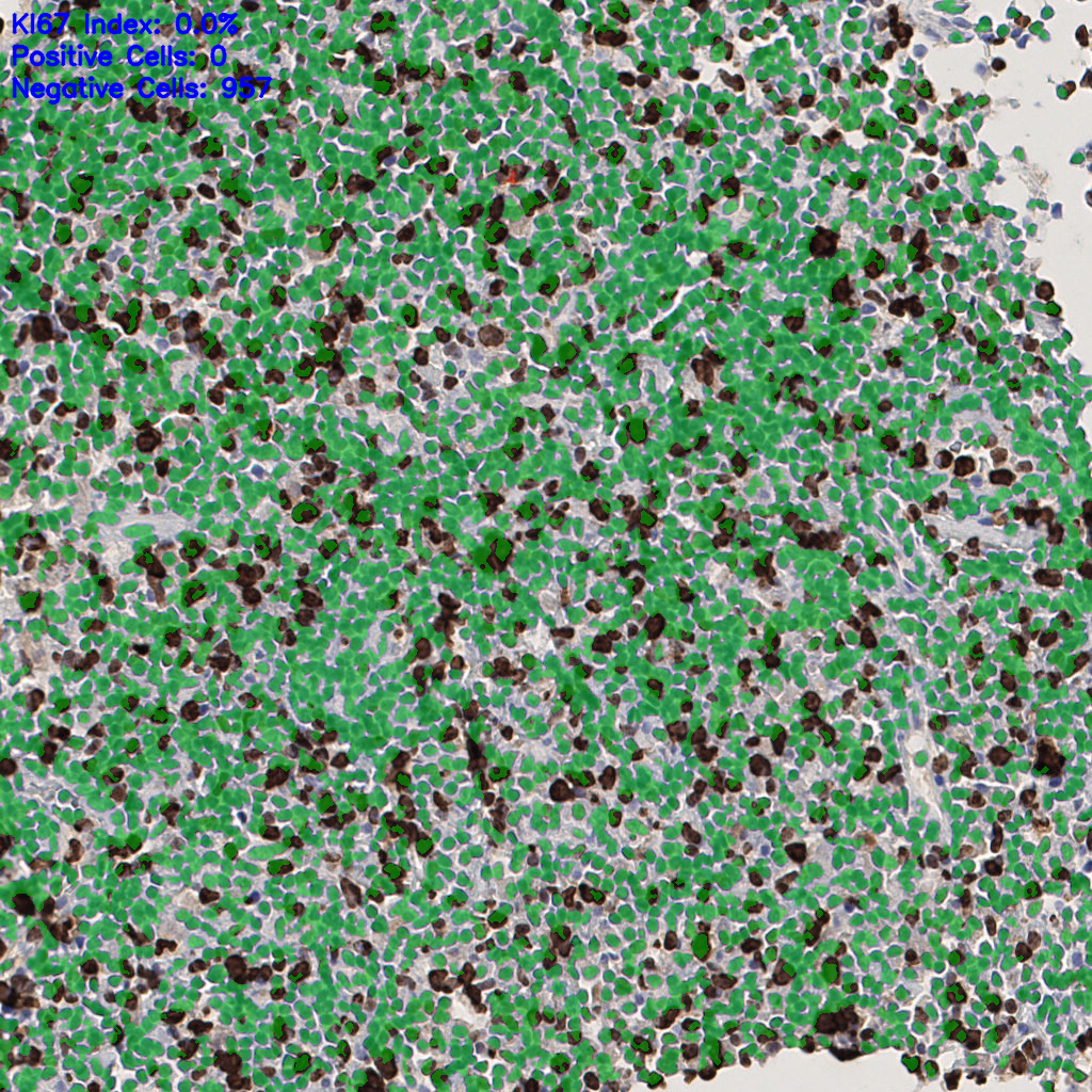 slice_50_4_x44800_y3584.png