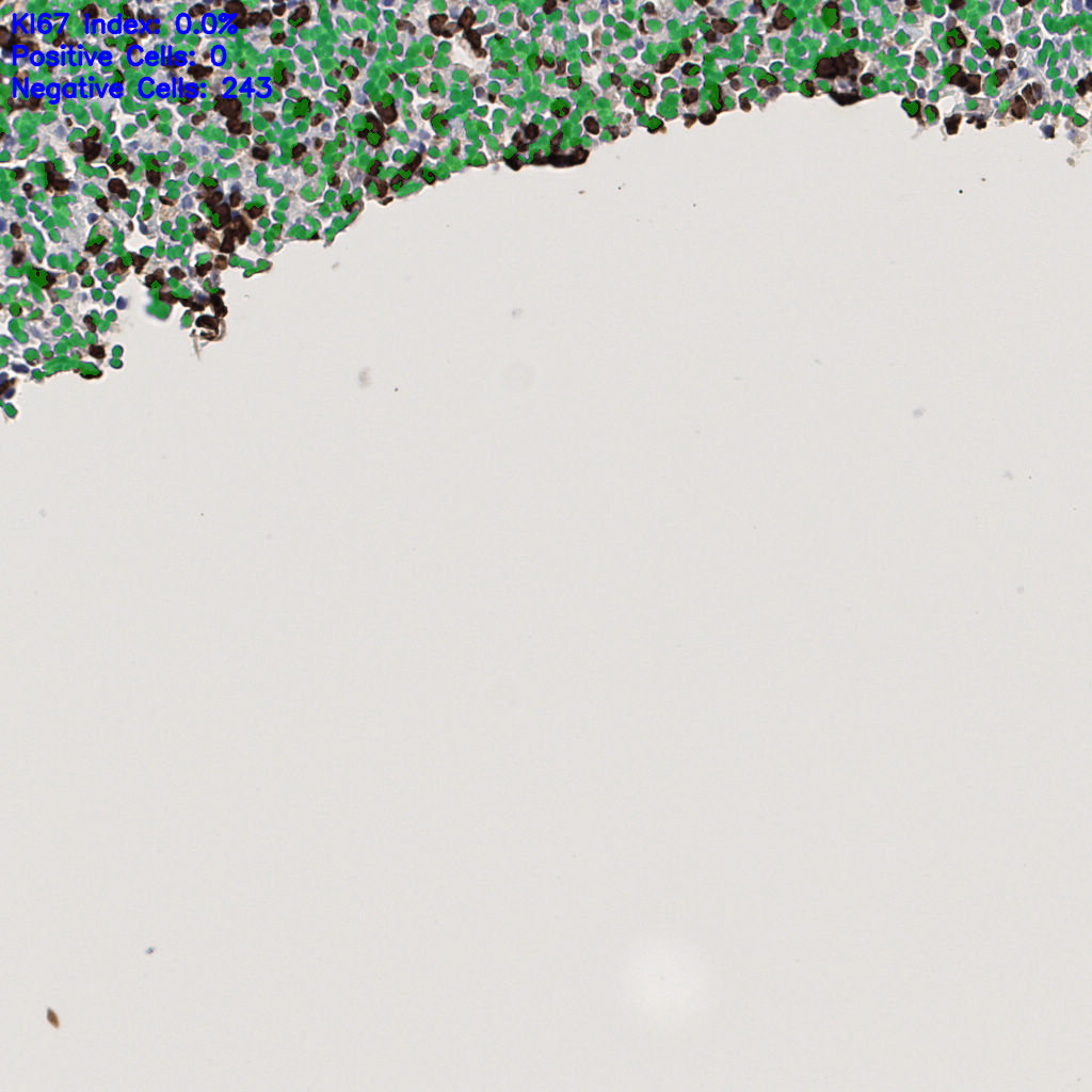 slice_50_5_x44800_y4480.png