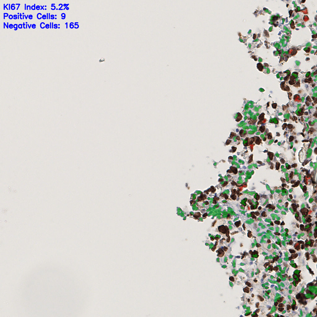 slice_51_16_x45696_y14336.png