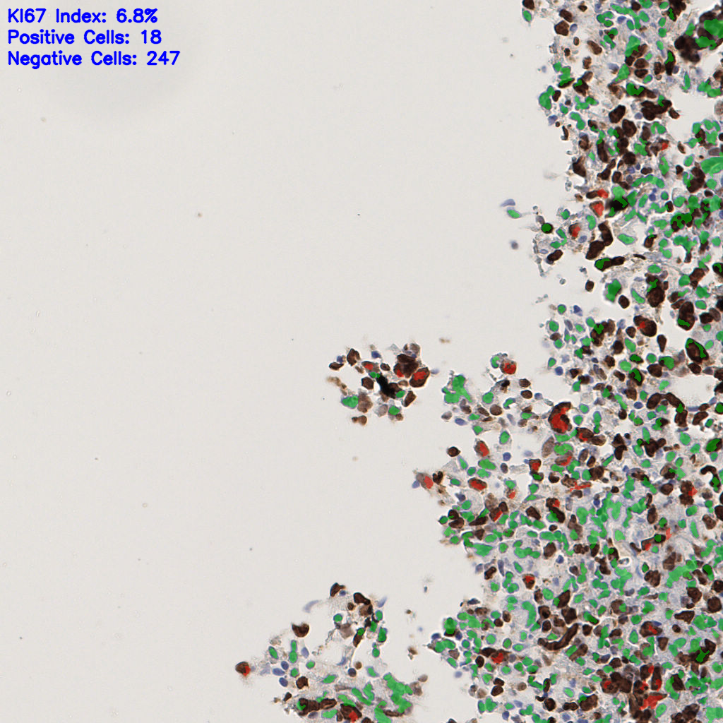 slice_51_17_x45696_y15232.png