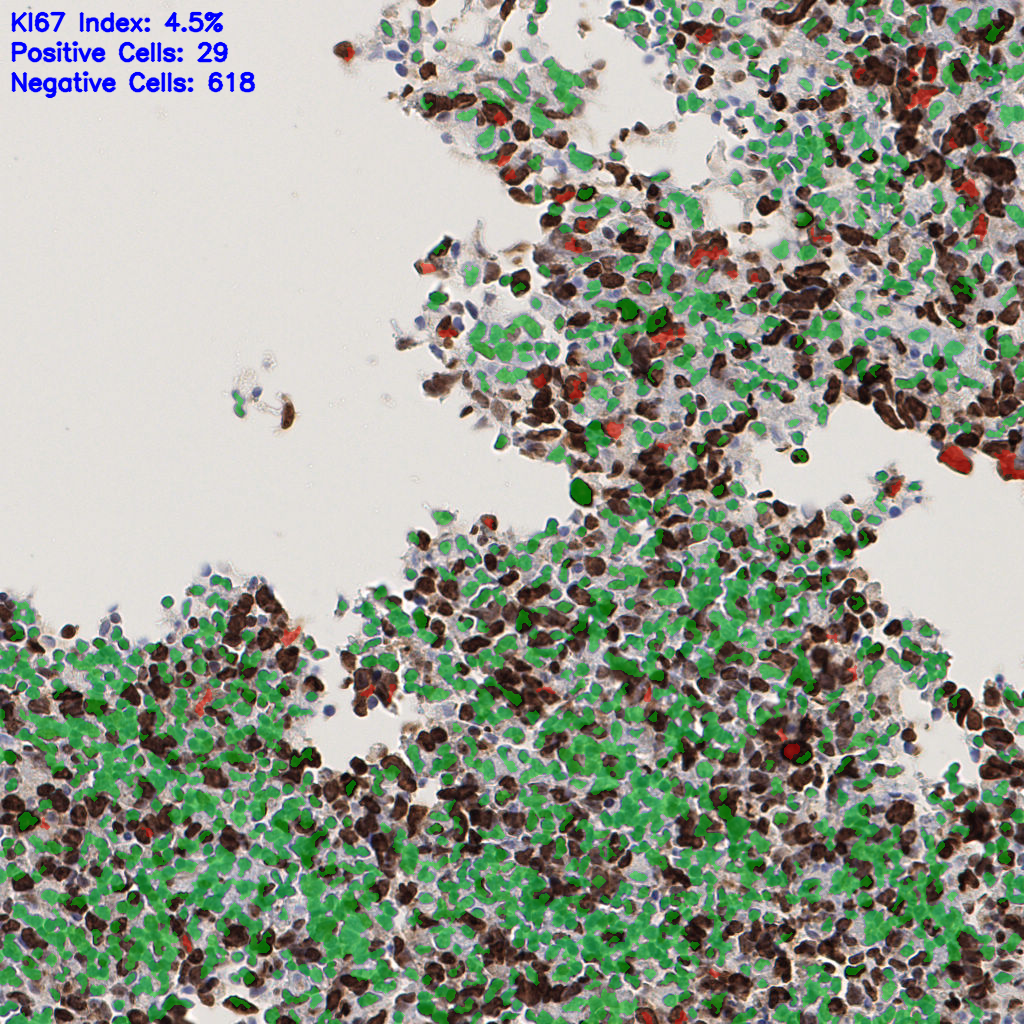slice_51_18_x45696_y16128.png