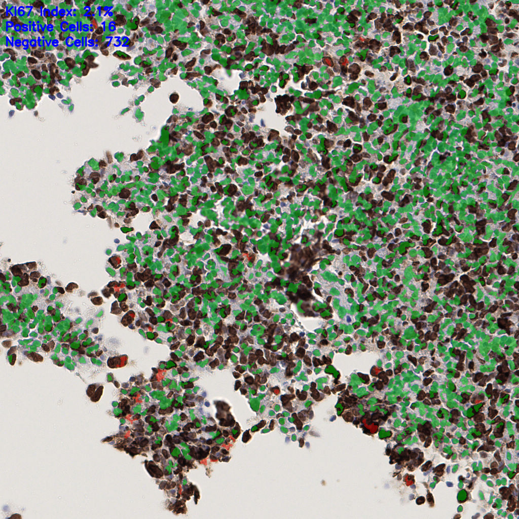 slice_51_19_x45696_y17024.png