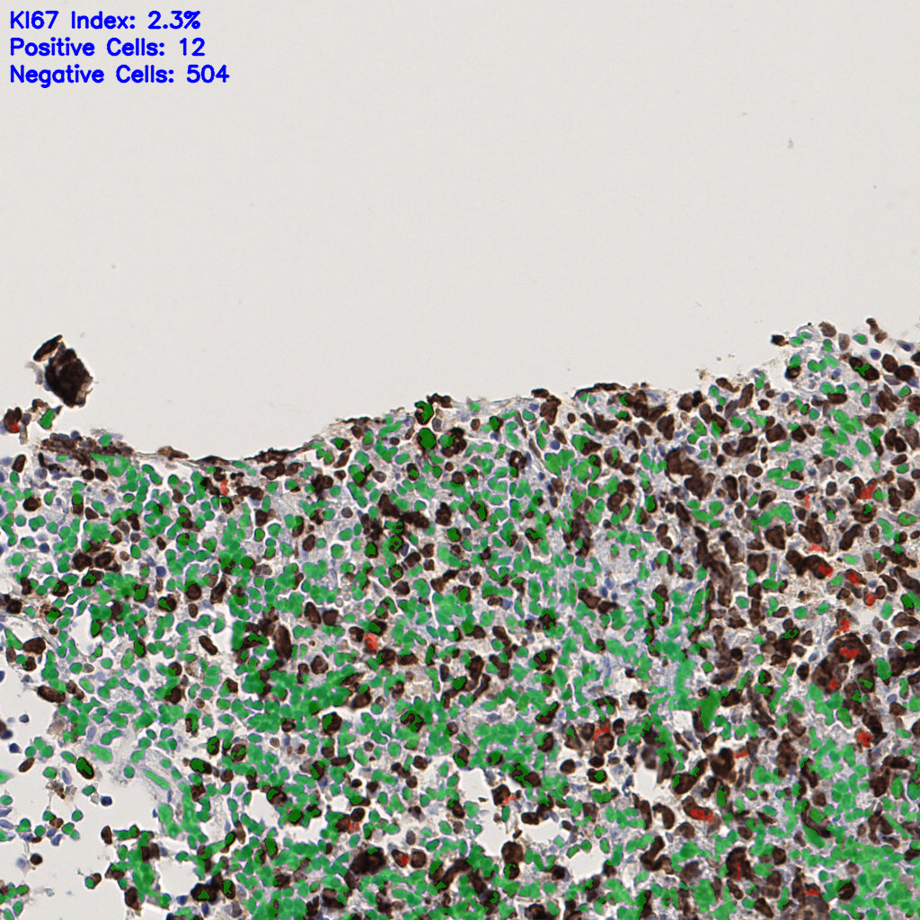 slice_51_3_x45696_y2688.png
