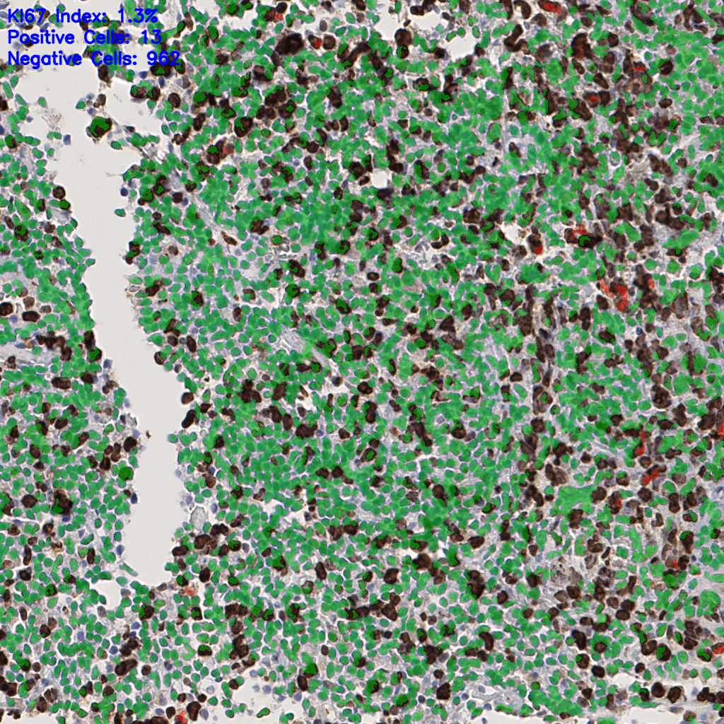 slice_51_4_x45696_y3584.png