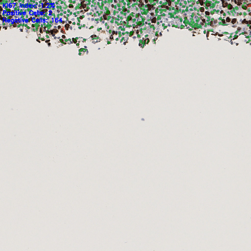 slice_51_5_x45696_y4480.png