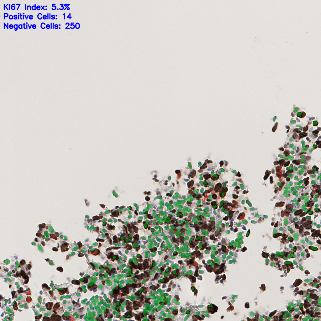 slice_52_15_x46592_y13440.png