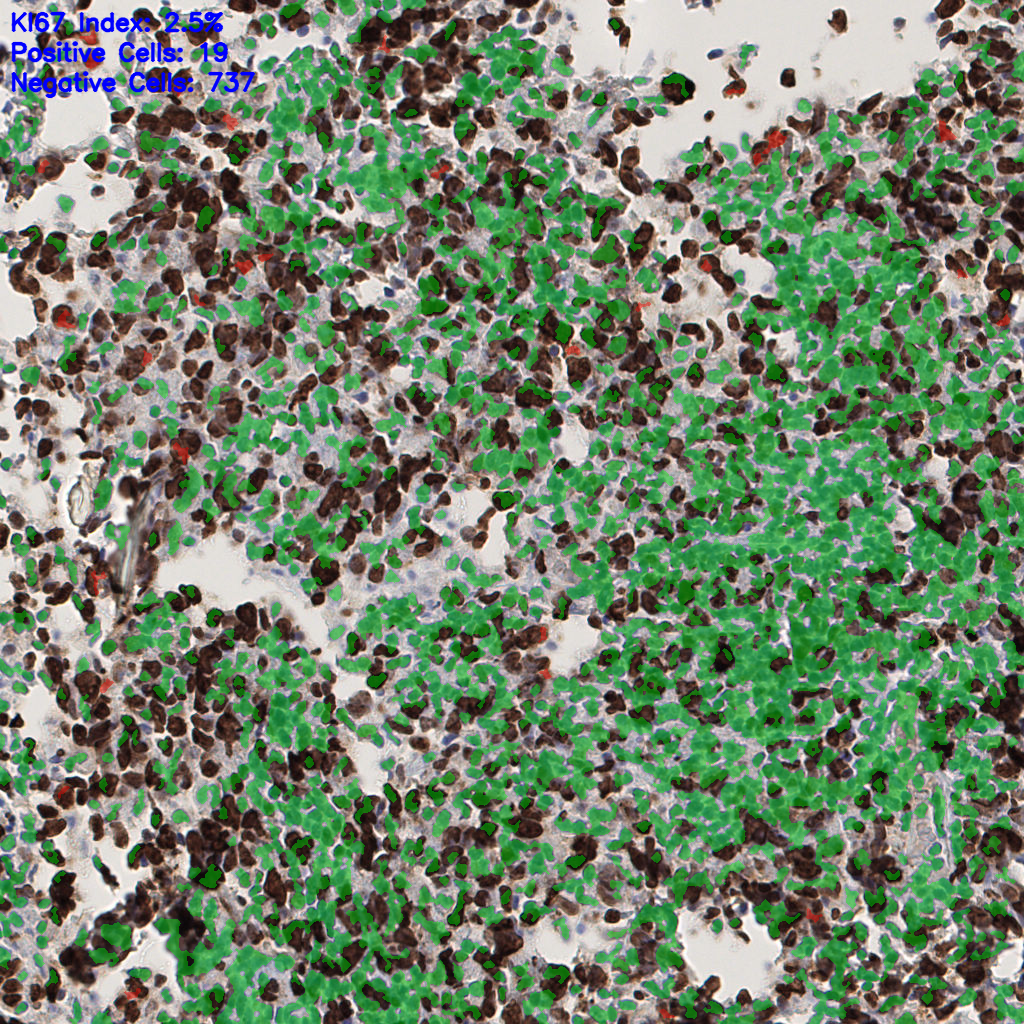 slice_52_16_x46592_y14336.png