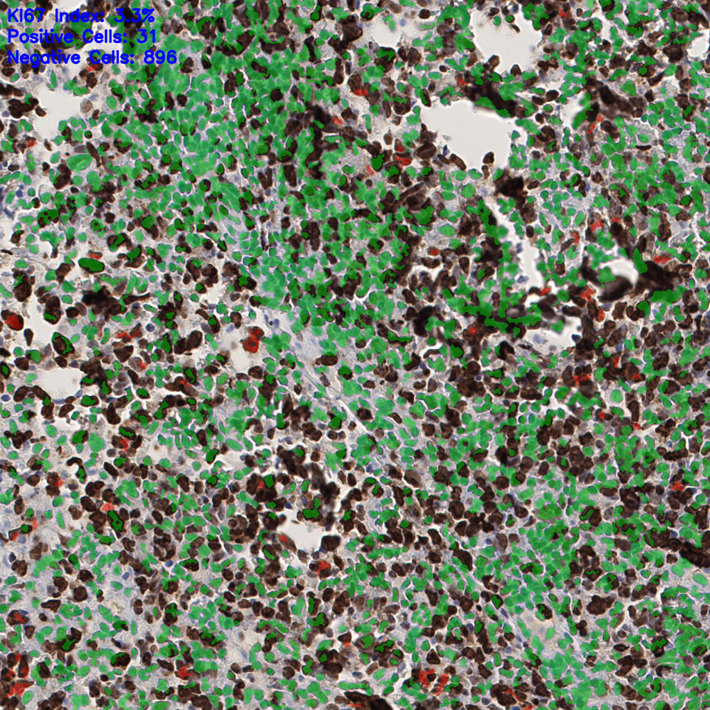 slice_52_17_x46592_y15232.png