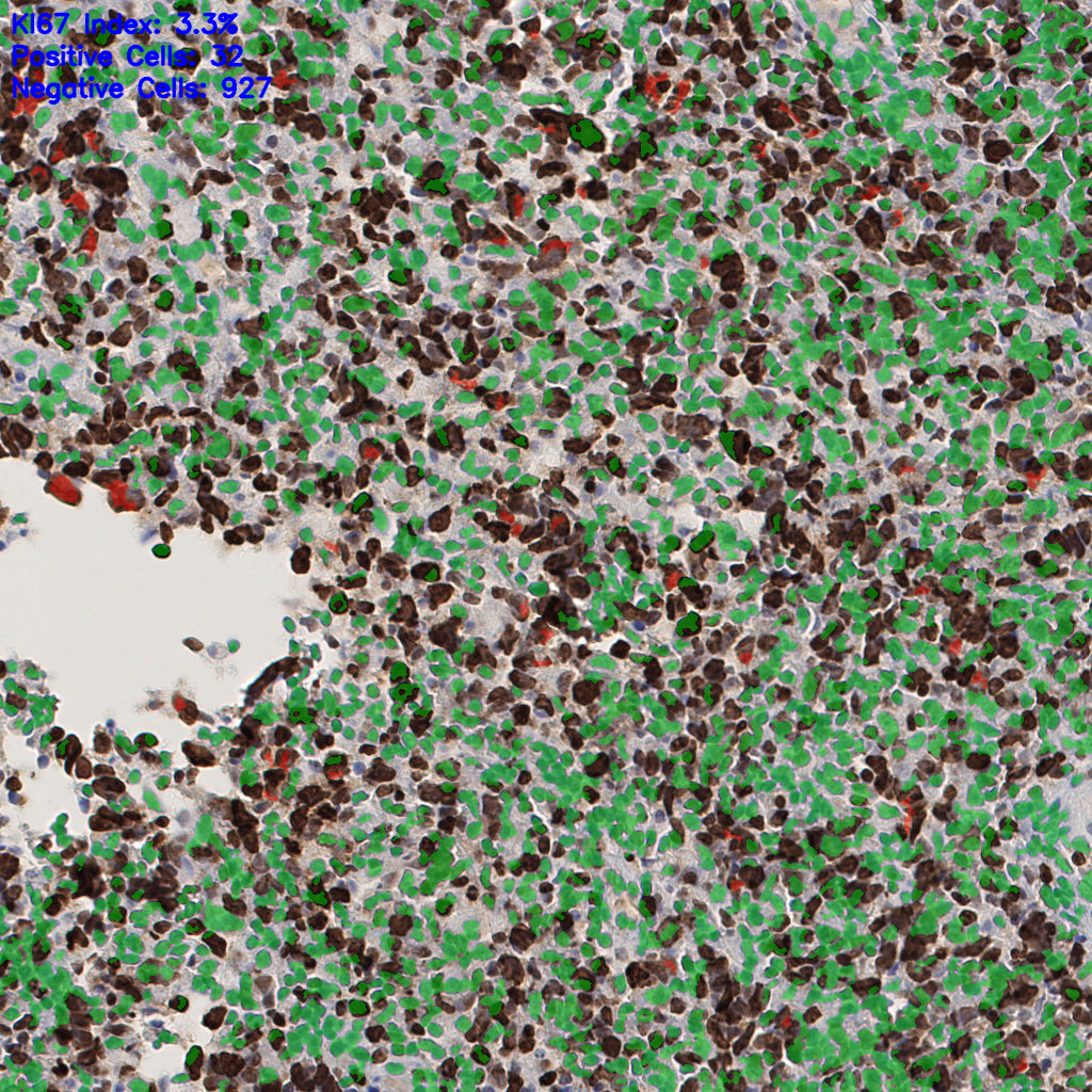 slice_52_18_x46592_y16128.png