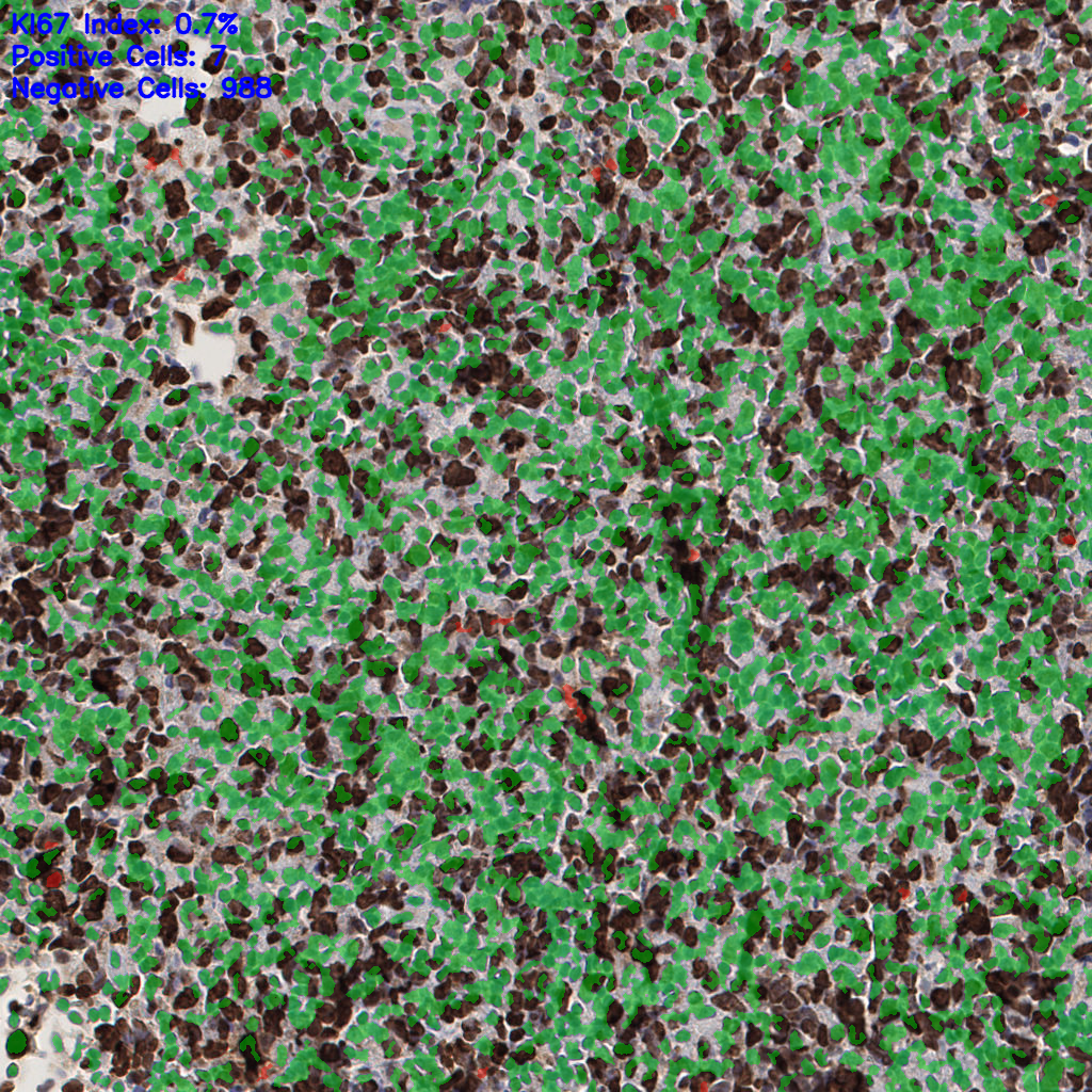 slice_52_19_x46592_y17024.png