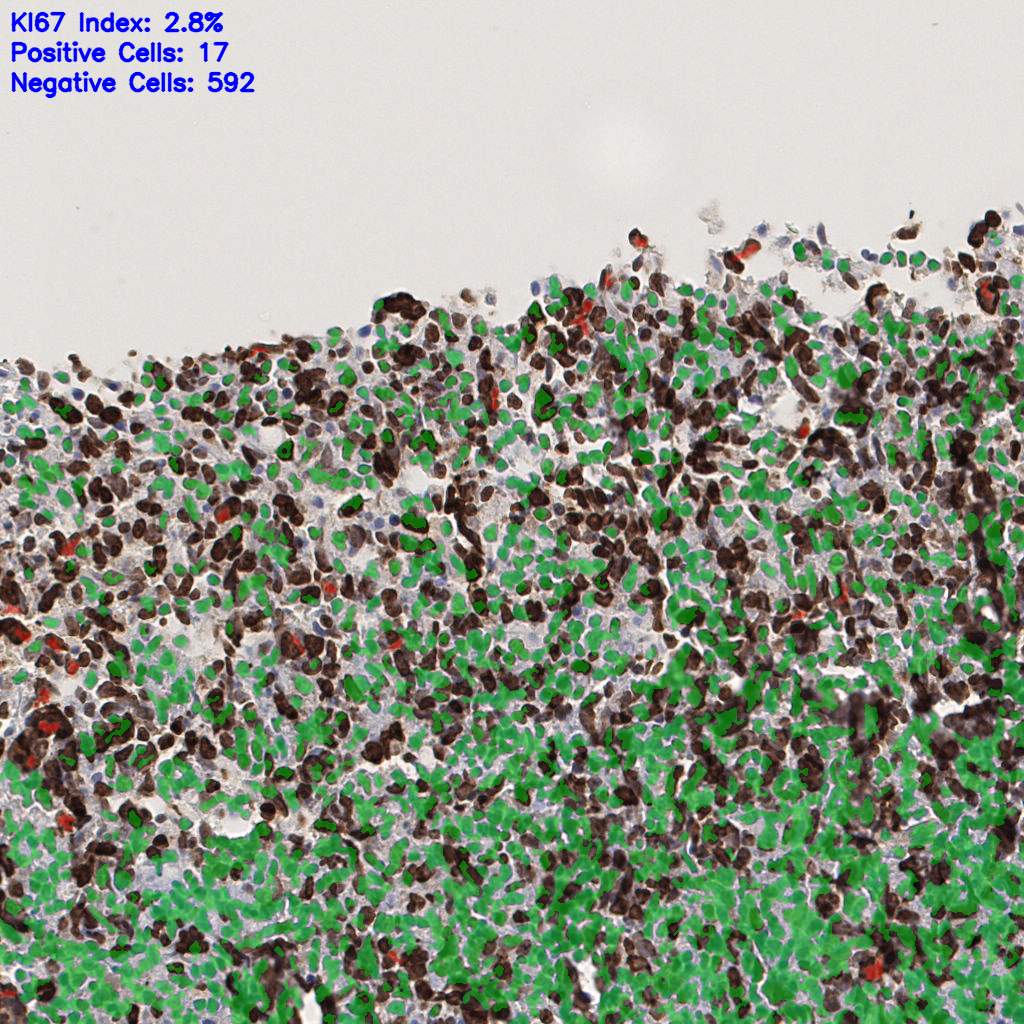 slice_52_3_x46592_y2688.png