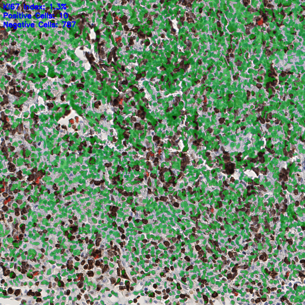 slice_52_4_x46592_y3584.png