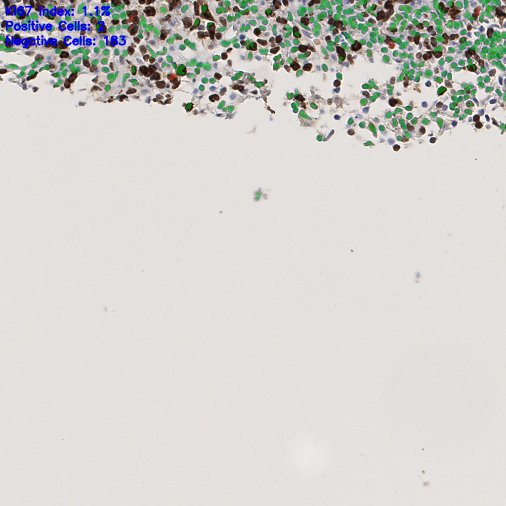 slice_52_5_x46592_y4480.png