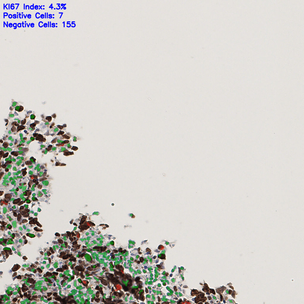 slice_53_15_x47488_y13440.png