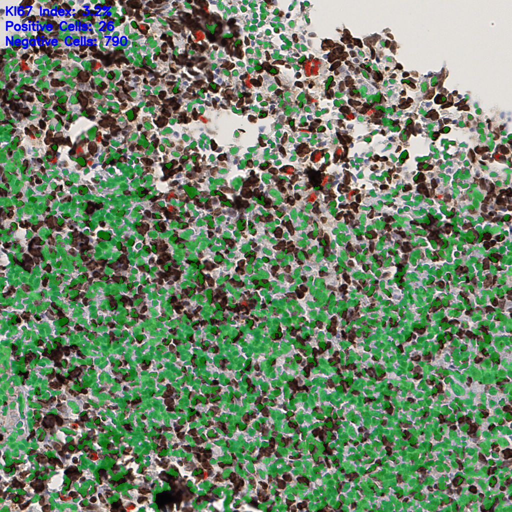 slice_53_16_x47488_y14336.png