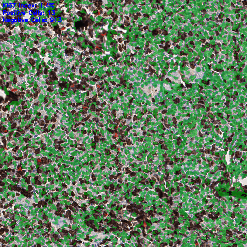 slice_53_17_x47488_y15232.png