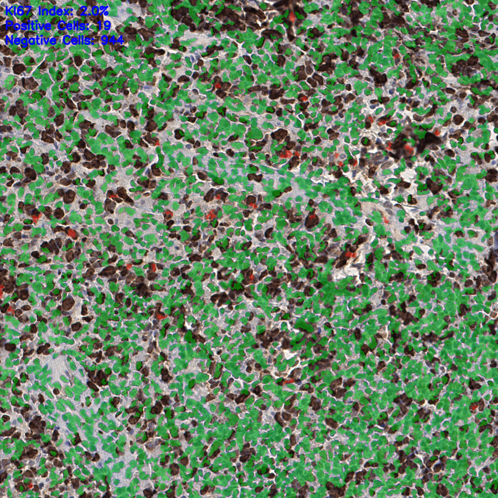 slice_53_18_x47488_y16128.png