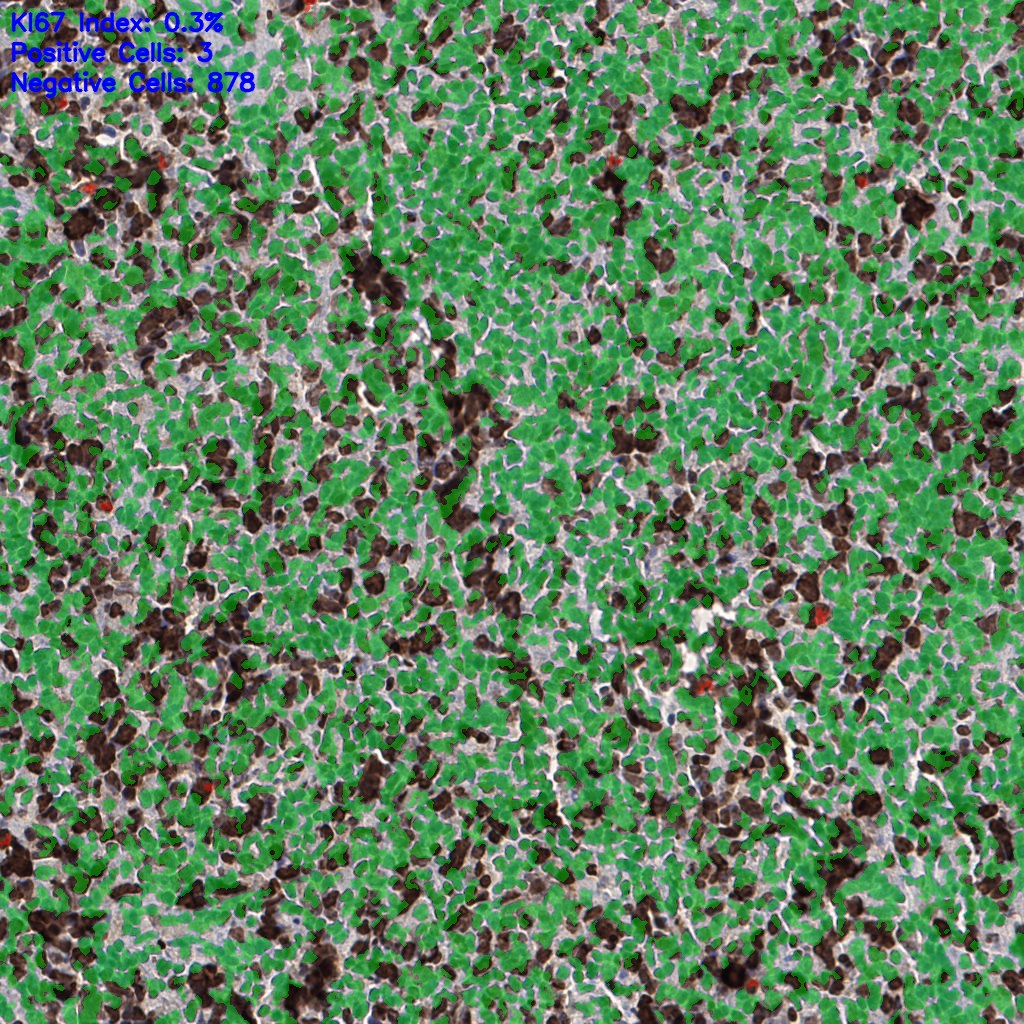 slice_53_19_x47488_y17024.png