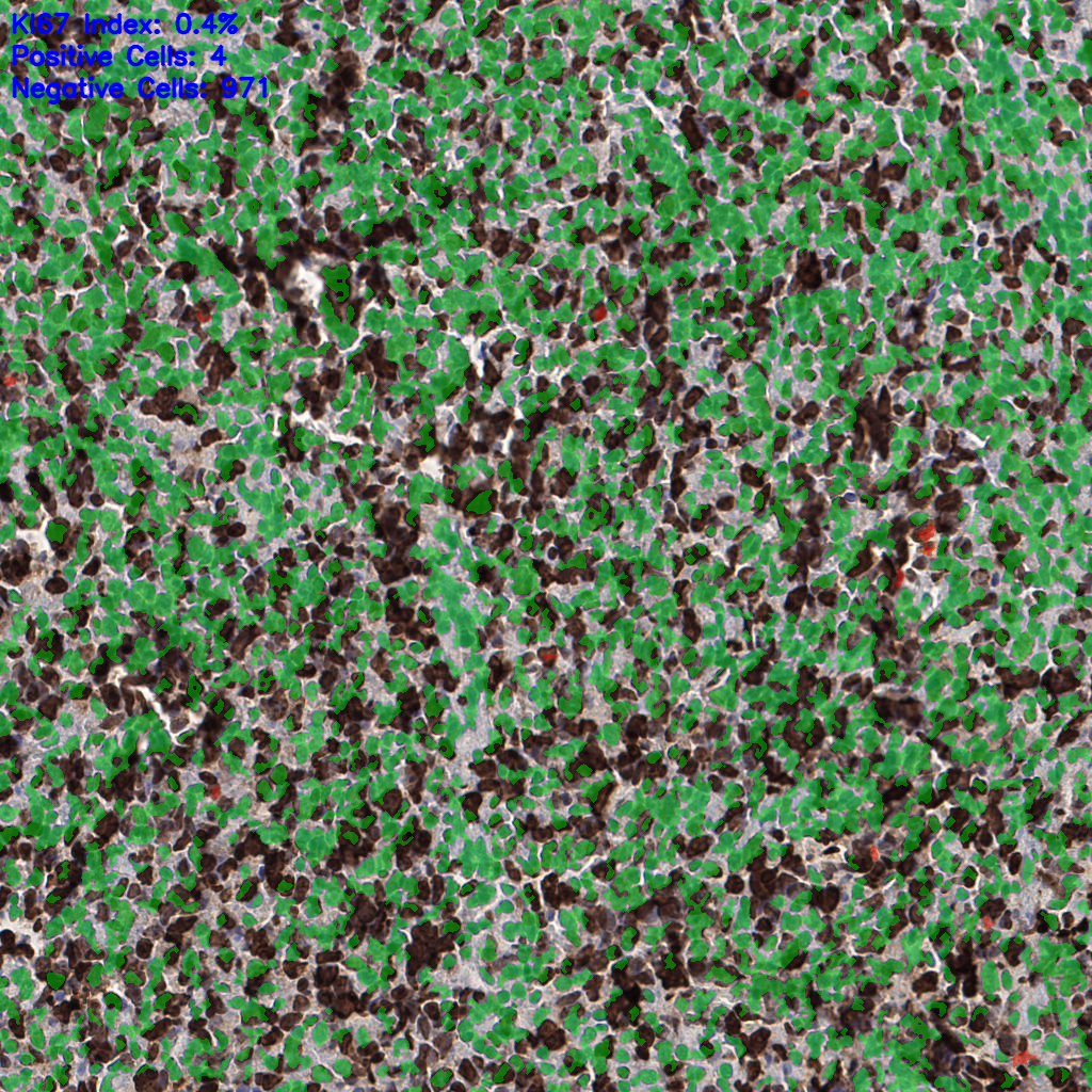 slice_53_20_x47488_y17920.png