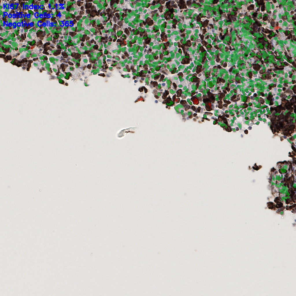 slice_53_21_x47488_y18816.png