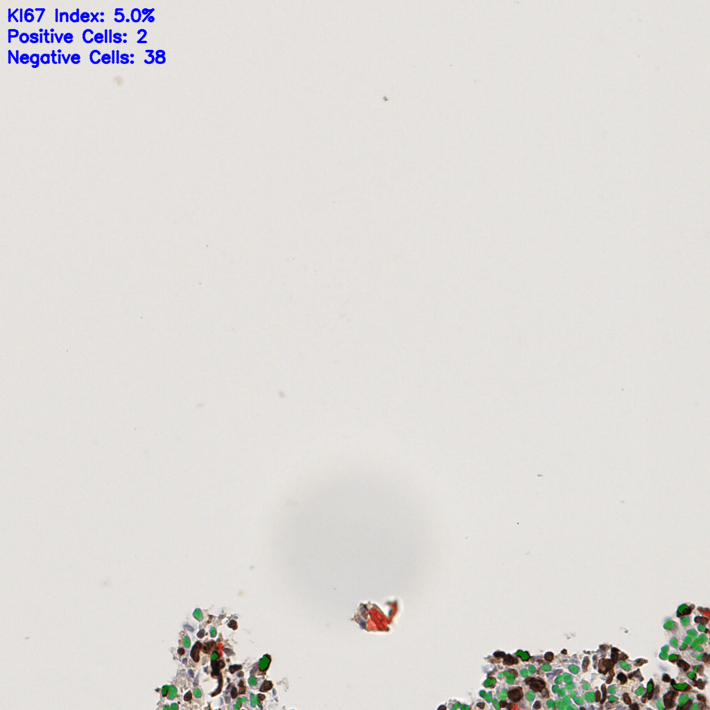 slice_53_2_x47488_y1792.png