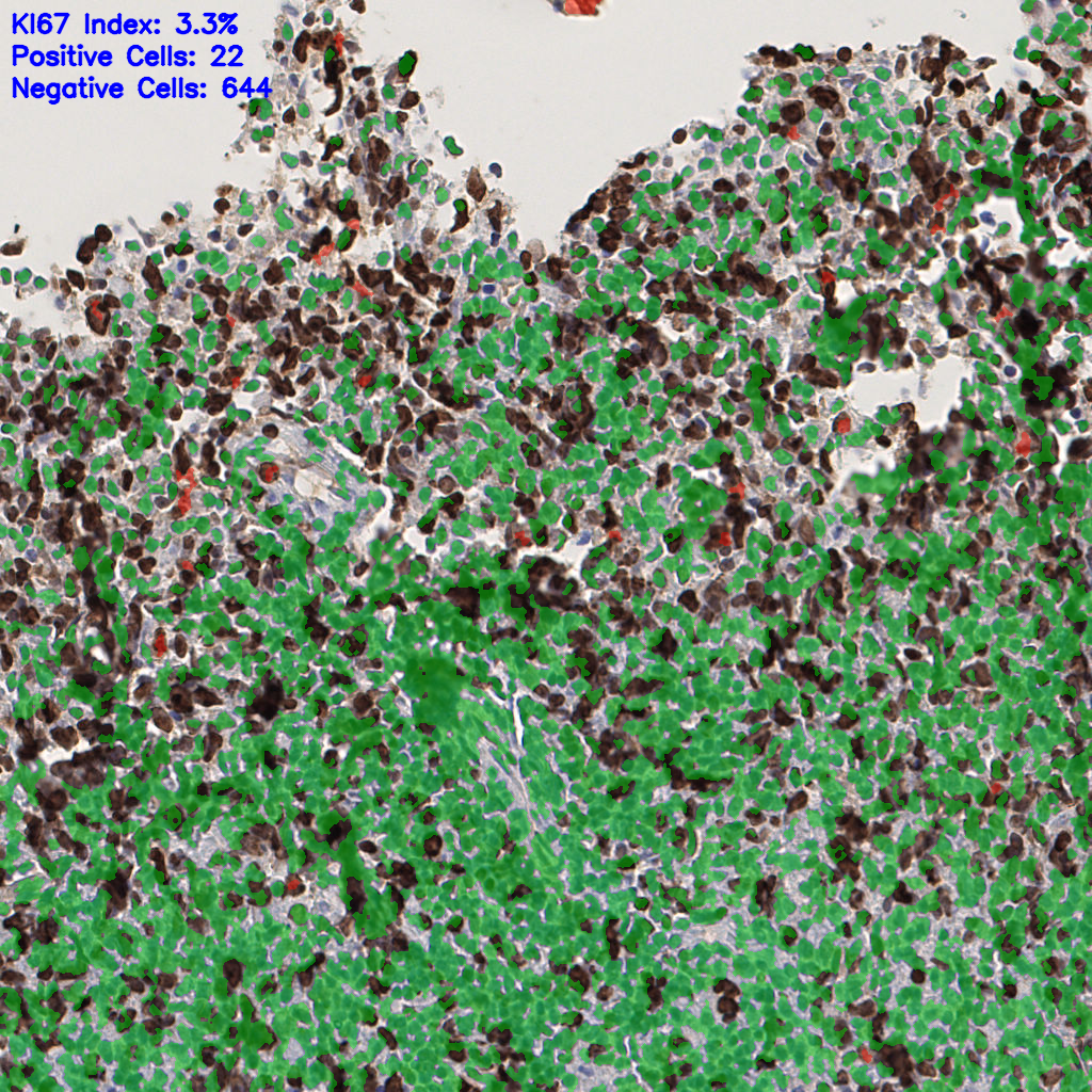 slice_53_3_x47488_y2688.png