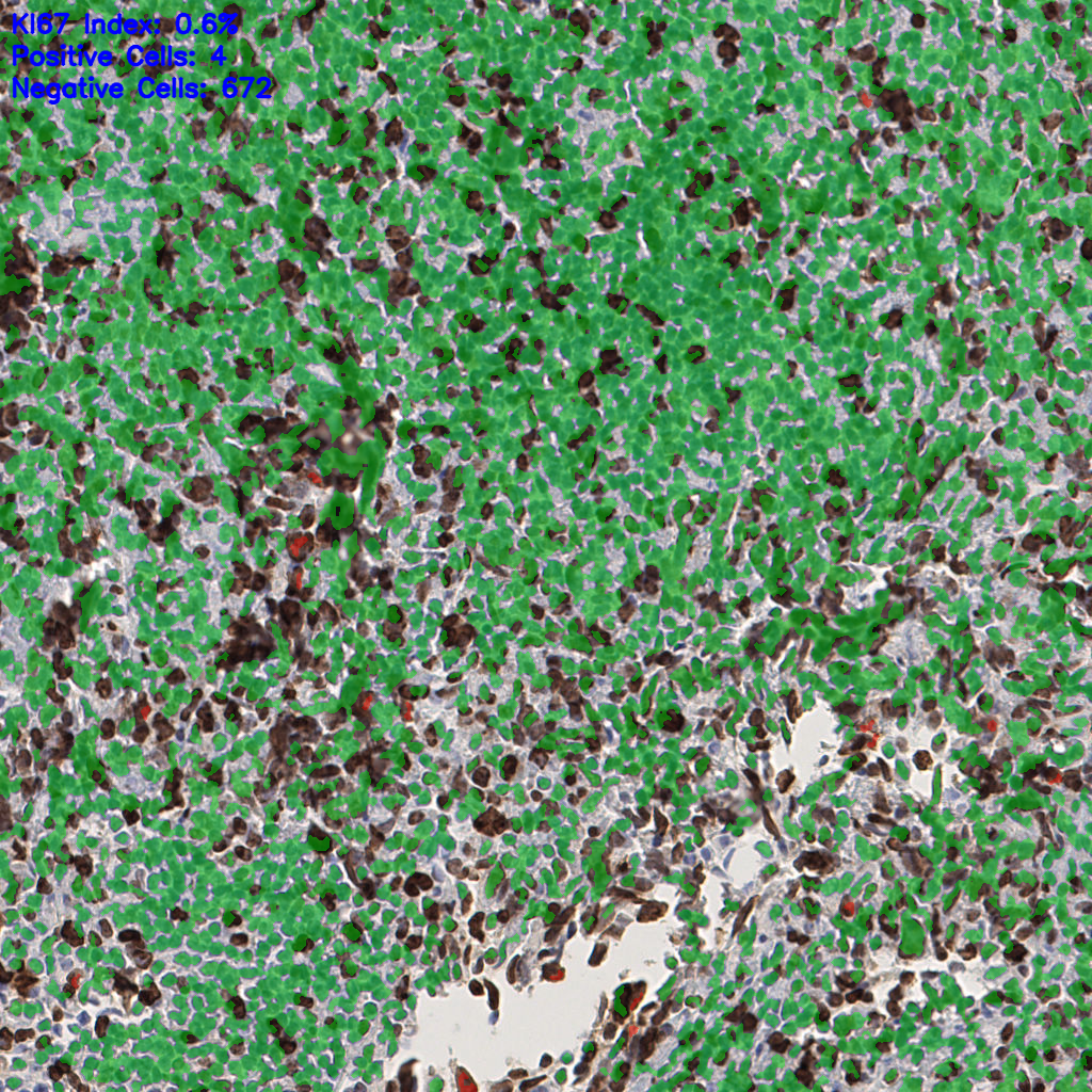 slice_53_4_x47488_y3584.png