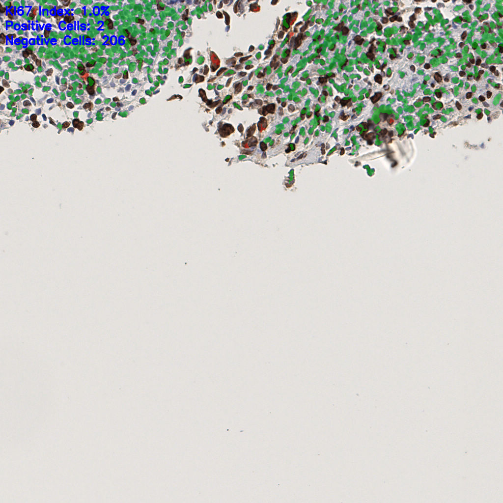 slice_53_5_x47488_y4480.png