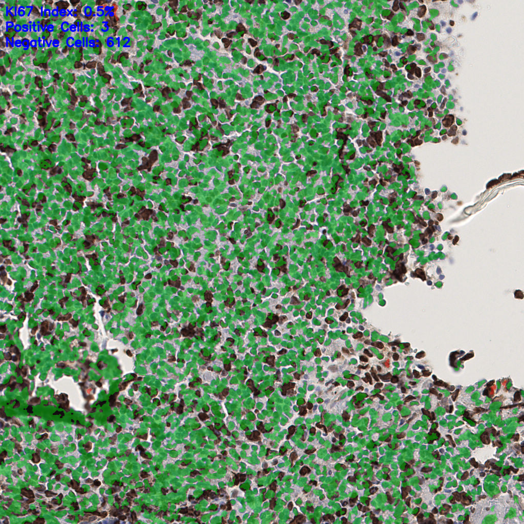 slice_54_17_x48384_y15232.png