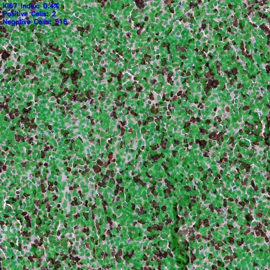 slice_54_19_x48384_y17024.png
