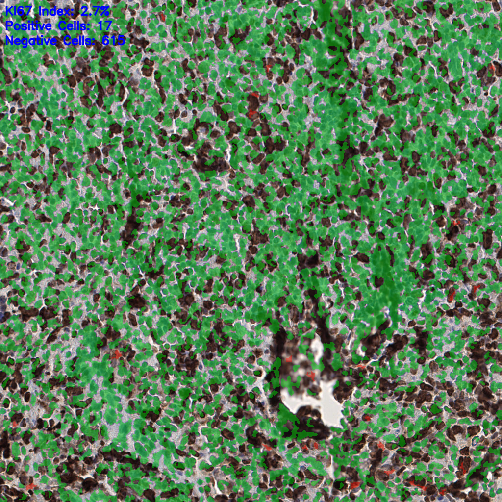 slice_54_20_x48384_y17920.png