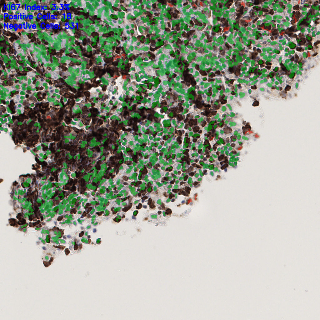 slice_54_21_x48384_y18816.png