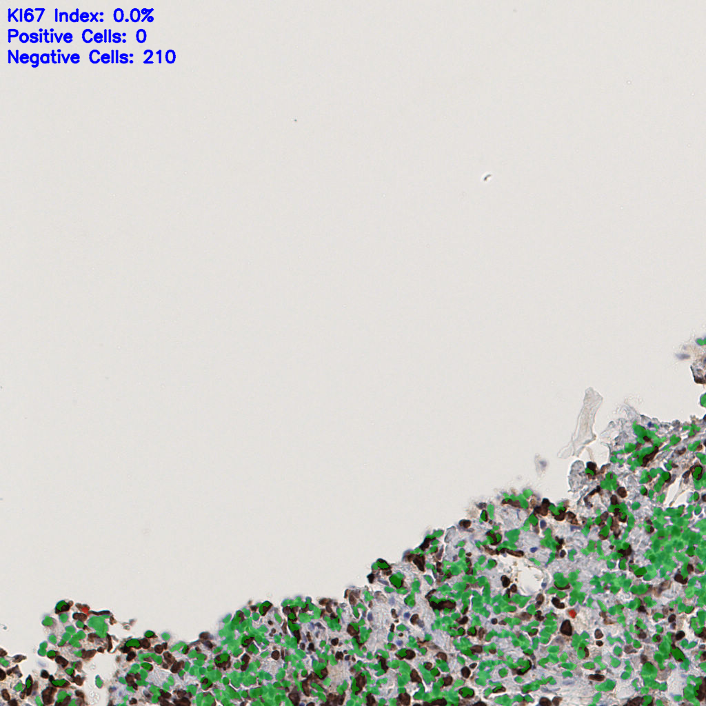 slice_54_2_x48384_y1792.png