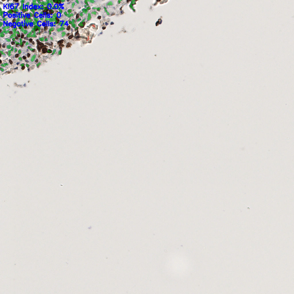 slice_54_5_x48384_y4480.png